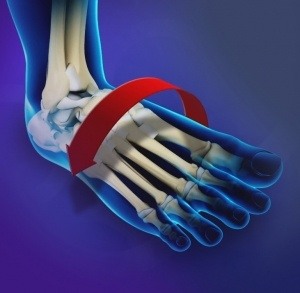 Ankle Instability