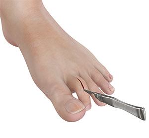        Lesser Toe Surgery         
